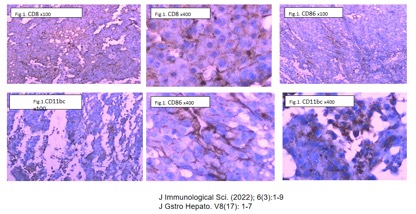 Triple-Function Imaging, Radiotherapy & Chemotherapy Drug